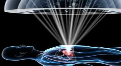 Stereotactic radiotherapy — precision radiation beams targeting tumor tissue with minimal impact on surrounding healthy organs