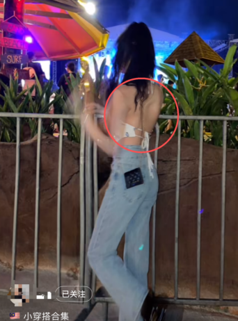 Xiao Ya (alias), a 23-year-old fashion blogger whose scoliosis is visible on her upper back