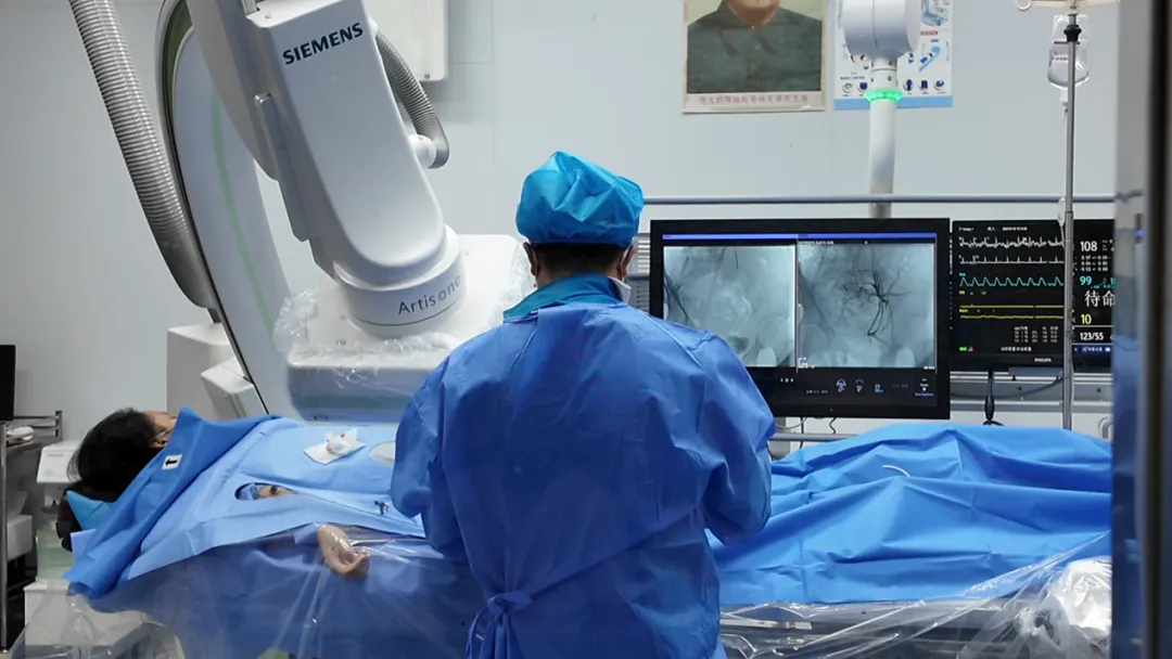 Equipo de oncología intervencionista de Chongqing HYGEIA Hospital realizando TACE bajo guía DSA usando el sistema de angiografía Siemens Artis one